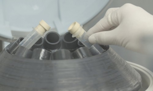 2.지방분리